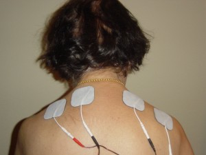 Eczema Patch On Back