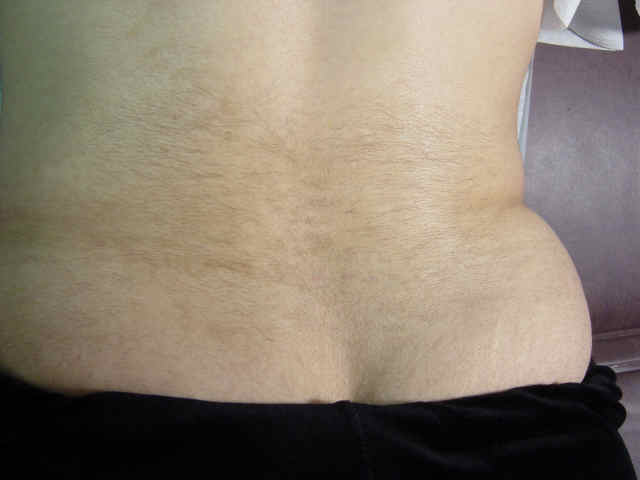 Hairy Lower Back 55